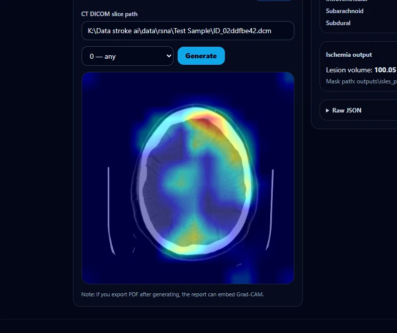 The explainability panel: a CT slice path, a class selector set to any haemorrhage, and a Grad-CAM heatmap over an axial CT slice, hottest near the top of the skull.
